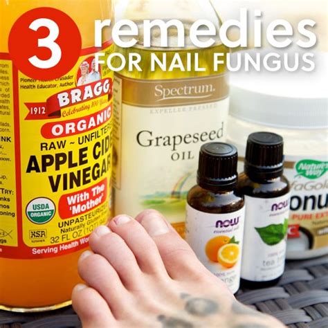 3 Simple Home Remedies For Toenail Fungus