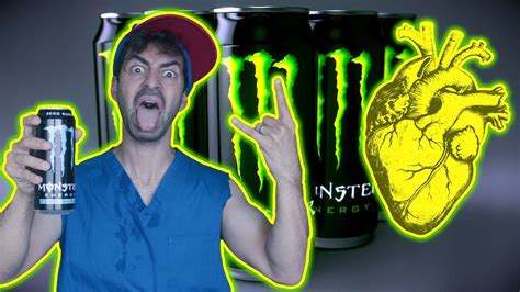 A Student Drank 2L Of Energy Drink A Day Here S What Happened To His Heart Medpage Today