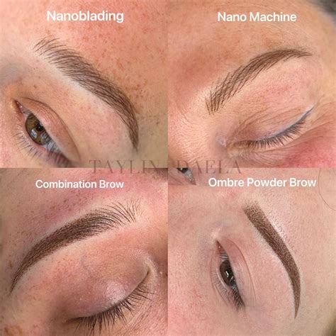 Blog Eyebrow Tattoos Emergency Brow Tattoo Removal Answering Your