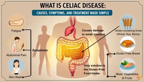 Celiac Disease Causes Symptoms And Treatment Options