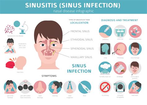 Chronic Sinusitis Symptoms Of Sinus Infection Sinus Treatment