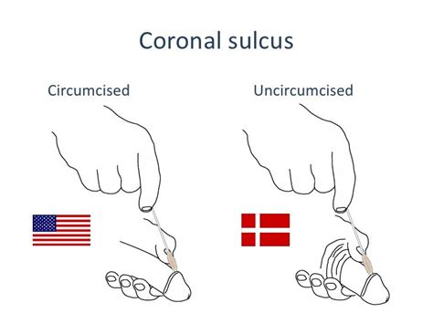 Circumcised Vs Uncircumcised Diagram How To Care For An Unci