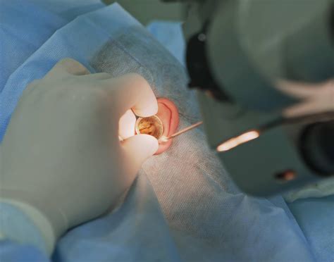 Ear Surgery: Unveiling Minimally Invasive Procedures and Their Benefits