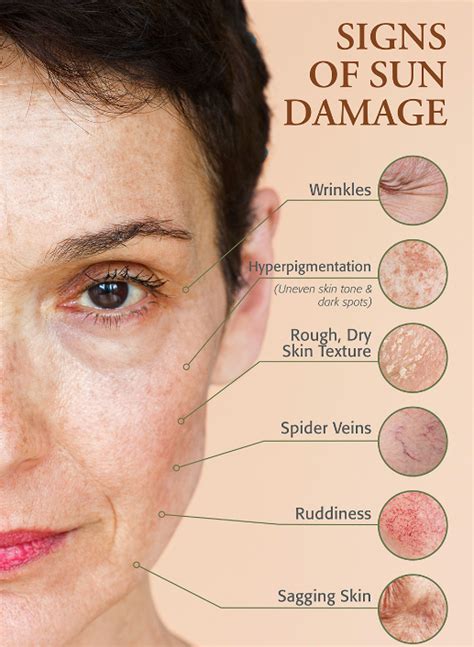 Let These Kind Truck Drivers Who Shared The Portraits Of Their Sun Damage From Driving For 30 Years Be Our Wake Up Call Sun Damage Isn T Just About Hyperpigmentation Freckles And Sun Spots Uv Rays