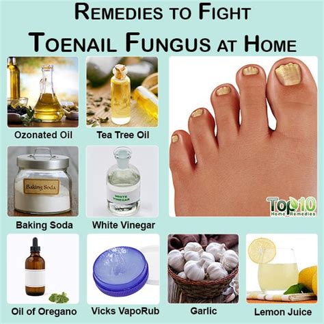 Natural Remedies To Treat Toenail Fungus At Home