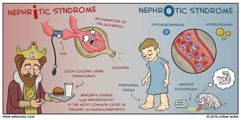 Nephritis vs Nephrotic Syndrome: Key Differences