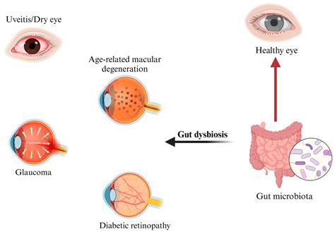 Targeting The Gut Eye Axis An Emerging Strategy To Face Ocular Diseases Targeting The Gut Eye Axis An Emerging Strategy To Face Ocular Diseases