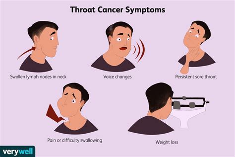 Throat Cancer Symptoms These Are The Early Signs Of Throat Cancer