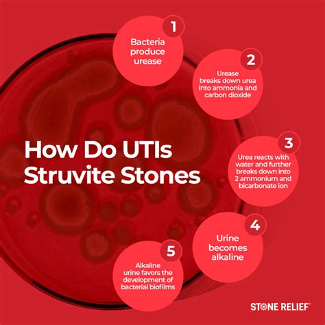 UTI vs. Kidney Stone: Key Differences?