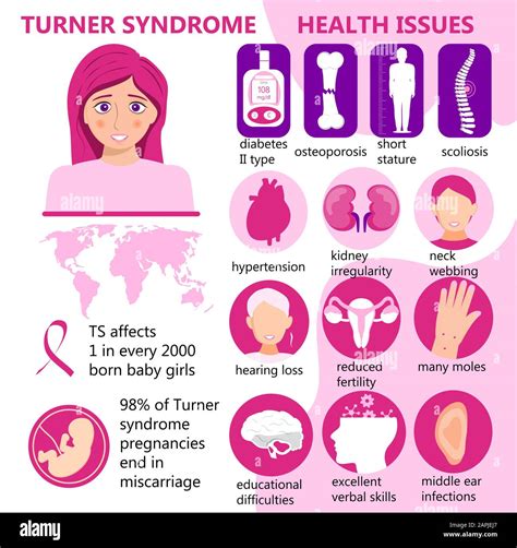 What Is Turners Syndrome
