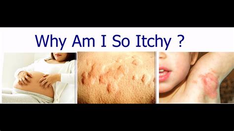 Why Am I So Itchy